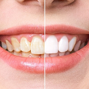 Cosmetic Dentistry