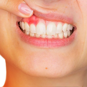 Periodontics