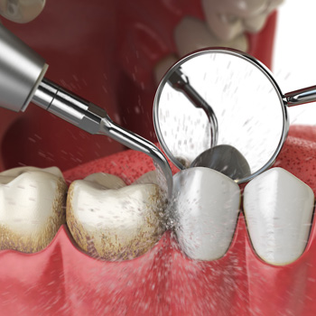 Preventive Dentistry