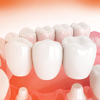 Restorative Dentistry